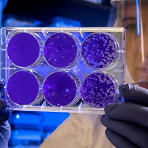 scientist in lab holding slides